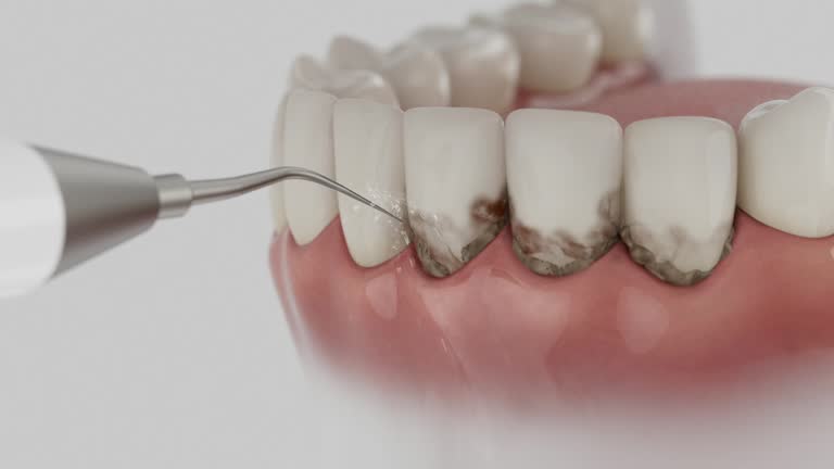 Reliable Dental Implants contractor in Marshall, MI by Smile Center Dentistry